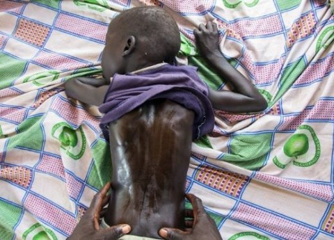 南蘇丹，「人禍」導致飢荒 600萬人瀕臨生命危機