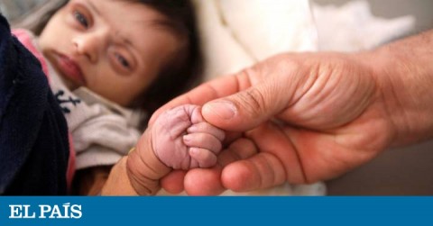 Una enfermera toma de la mano a una bebé de dos meses malnutrida dos días antes de morir, en el centro de Saná, en Yemen