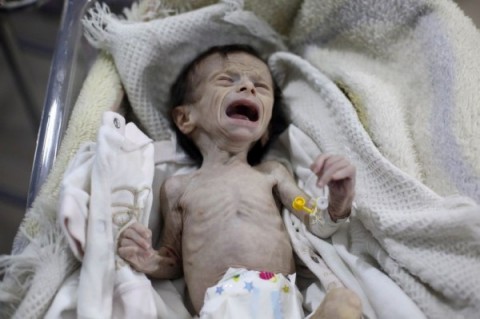敘利亞內戰不息 嬰兒慘如乾屍哀嚎求生