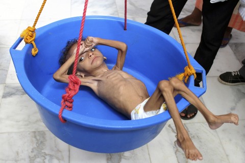 内戦続くイエメン、子ども500万人以上が飢餓に直面